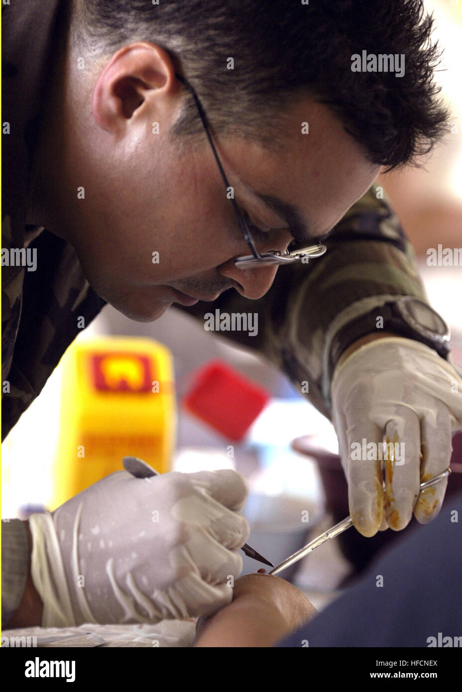 Lt. j.g. Orlando Rivera removes a wart from a patient's arm during a medical civil assistance program at Parang Elementary School in Cotabato, Philippines, on June 19, 2007. Rivera, attached to the Naval Medical Center San Diego, is currently embarked on USS Peleliu (LHA 5) in support of Pacific Partnership 2007. Peleliu is working with the Philippine government and non-governmental organizations to offer medical care as well as to complete construction and engineering projects during Pacific Partnership. Pacific Partnership Medical Treatment 67859 Stock Photo