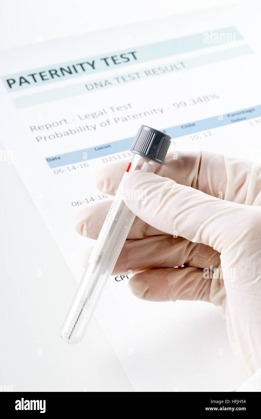 Doctor holding buccal swab in test tube on paternity DNA test result