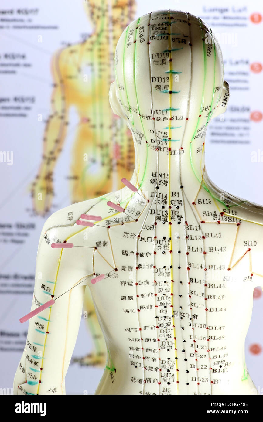 female acupuncture model with needles in the shoulder Stock Photo Alamy