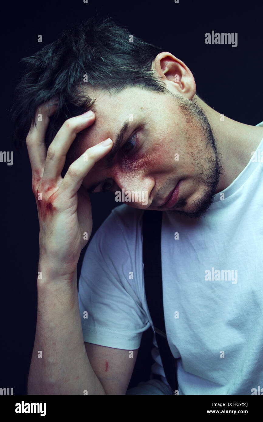 Young worried man with blood and injuries Stock Photo