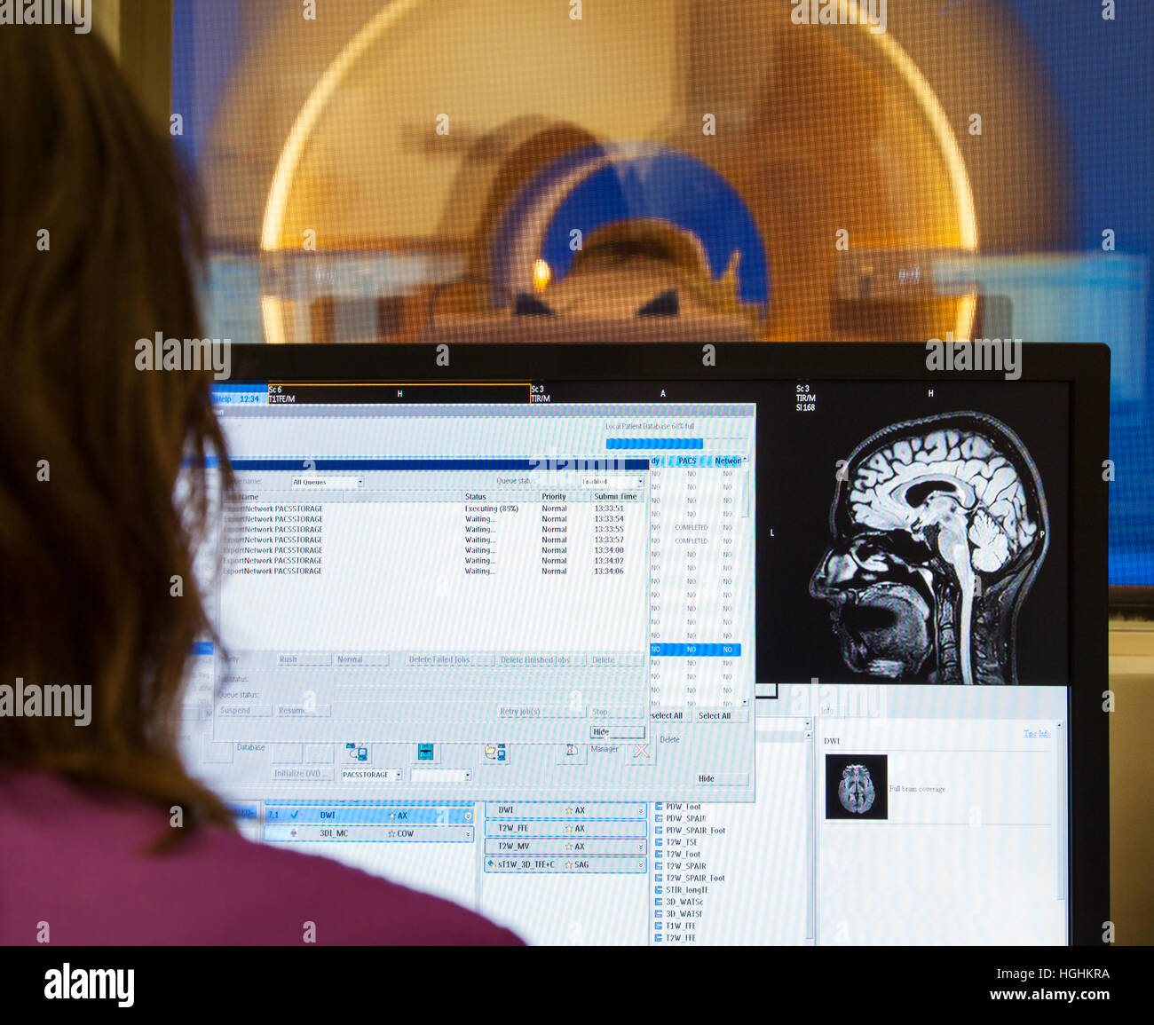 An operator is looking at images of scanned on MRI human brain in modern hospital. Stock Photo
