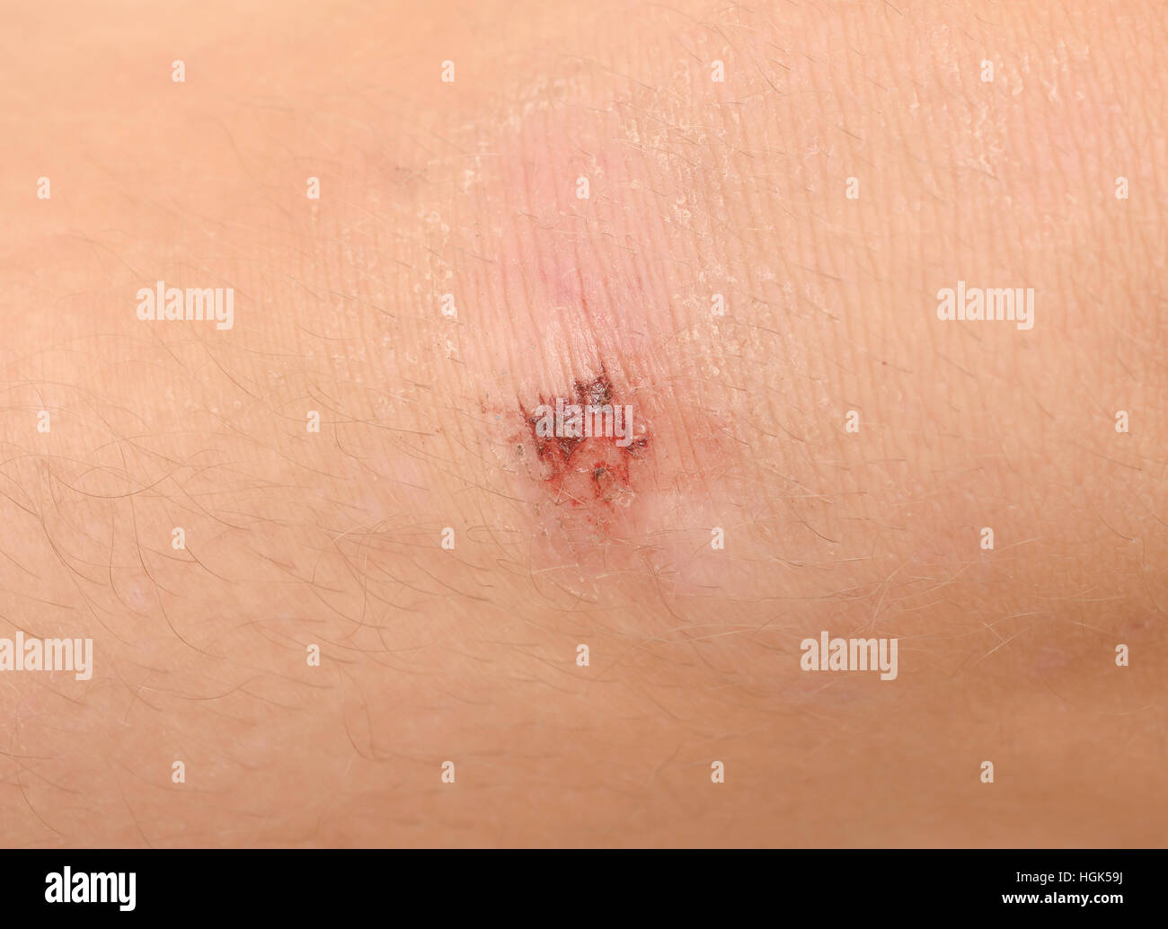 Scraped knees of a little childl on white Stock Photo Alamy