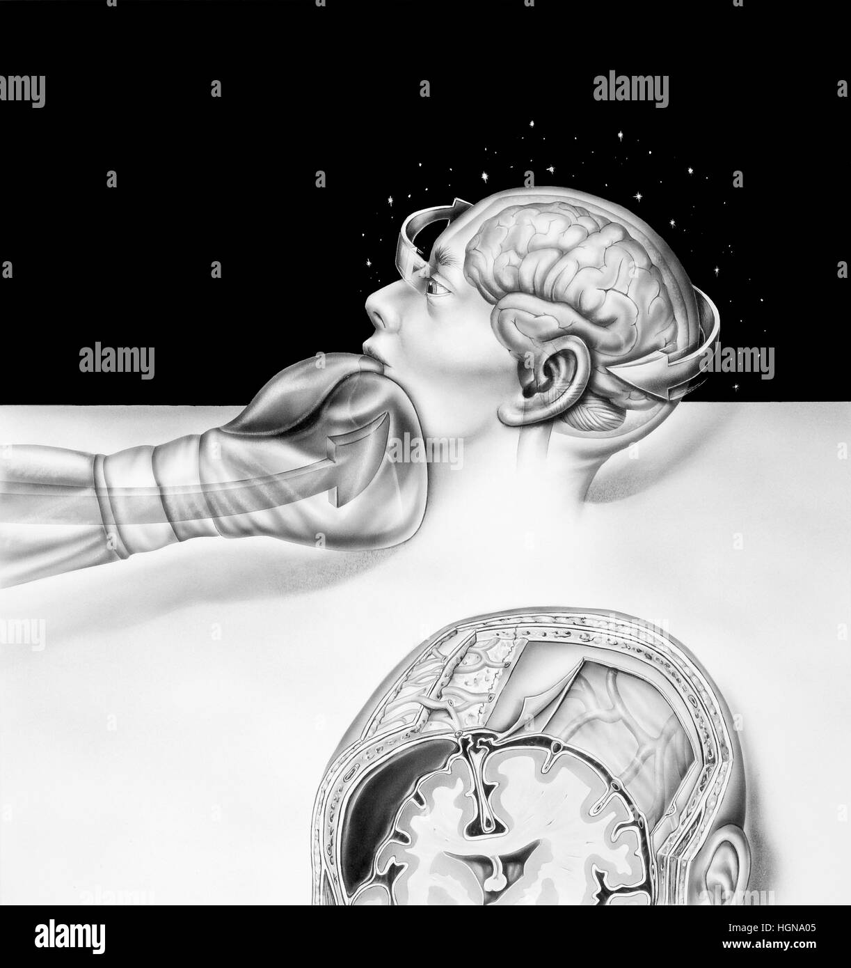 Shown are the regions of the human brain affected by boxing, side view ...