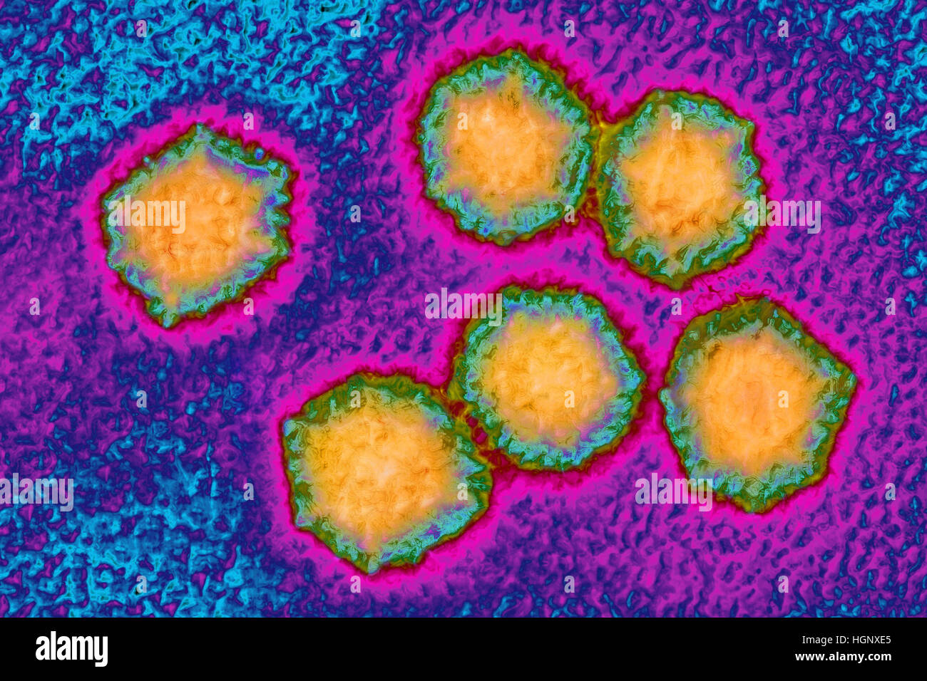 HEPATITIS A VIRUS Stock Photo