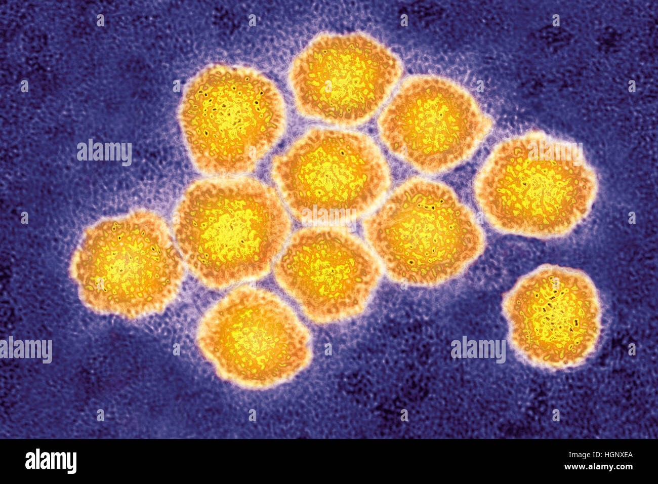 Hepatitis C Virus Microscope