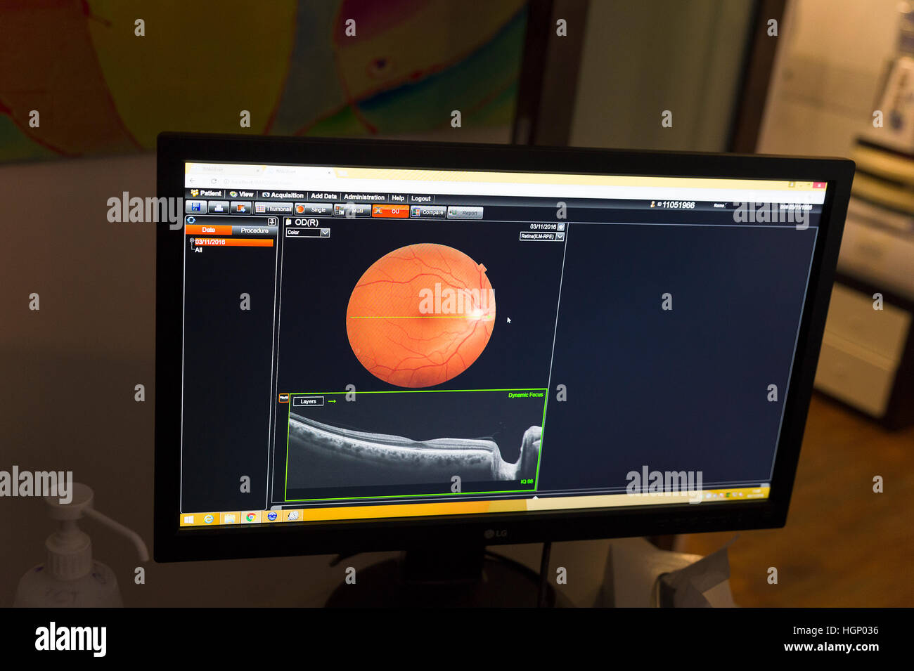 OPTICAL COHERENCE TOMOGRAPHY Stock Photo Alamy