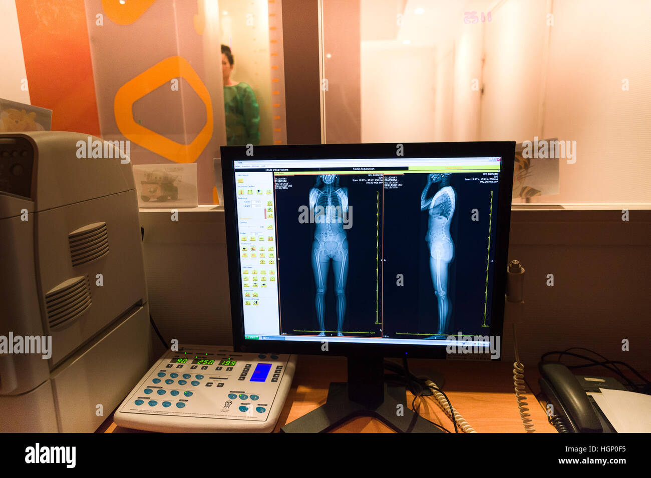 Eos X Raz EOS X-RAY IMAGING Stock Photo - Alamy