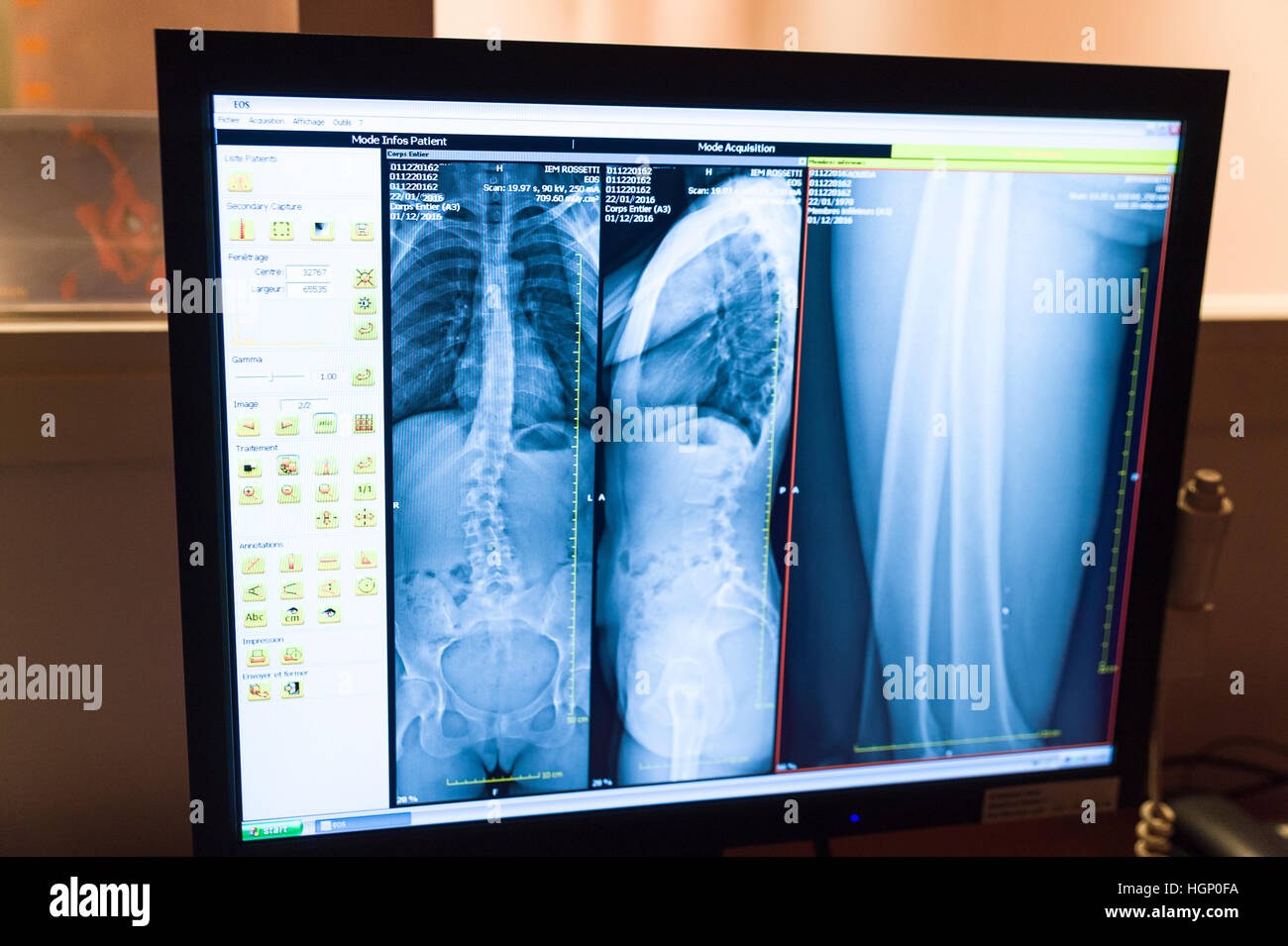 EOS X-RAY IMAGING Stock Photo - Alamy