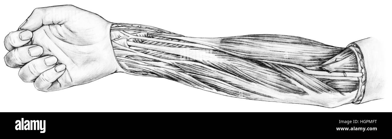 Shown are the medial brachial intermuscular septum, medial epicondyle, brachialis muscle, pronator teres muscle, flexor carpi radialis muscle, palmari Stock Photo