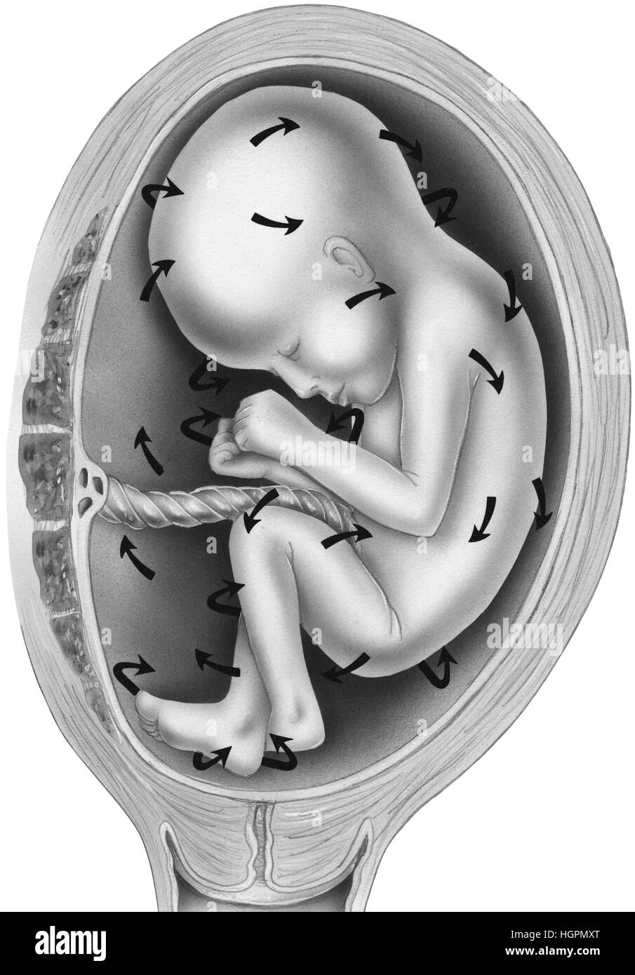 leaking amniotic fluid symptoms leaking amniotic fluid symptoms