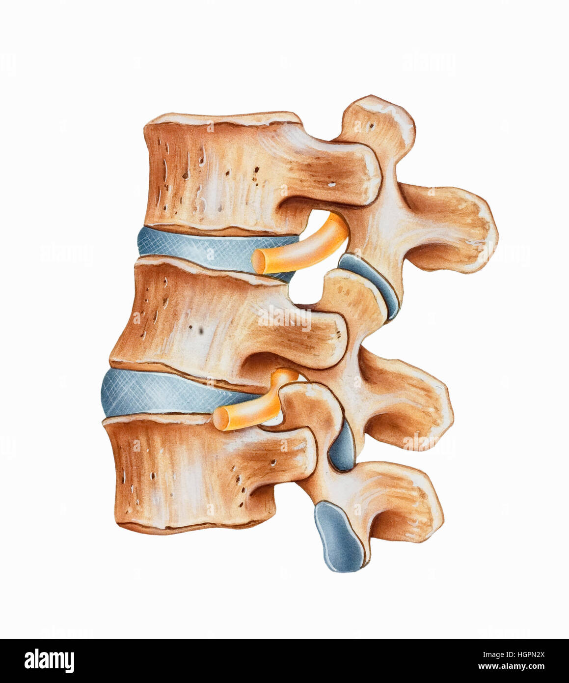 Spine Lumbar Hyperlordosis is an exaggerated curvature of the lumbar