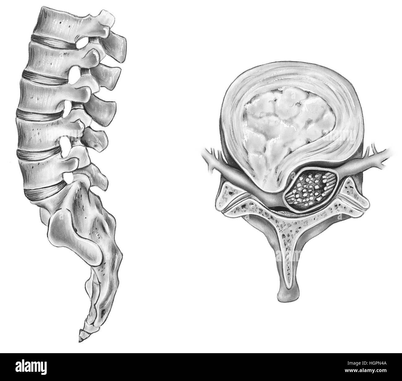 Spine Ruptured Intervertebral Disc Stock Photo Alamy