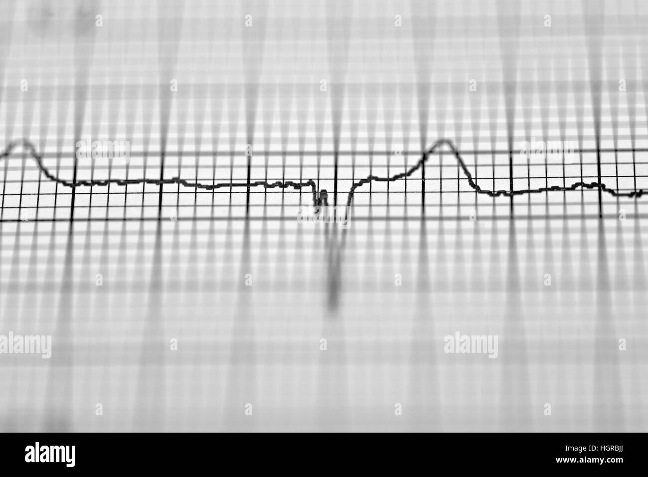 Electrocardiogram ekg graph printout Black and White Stock Photos ...
