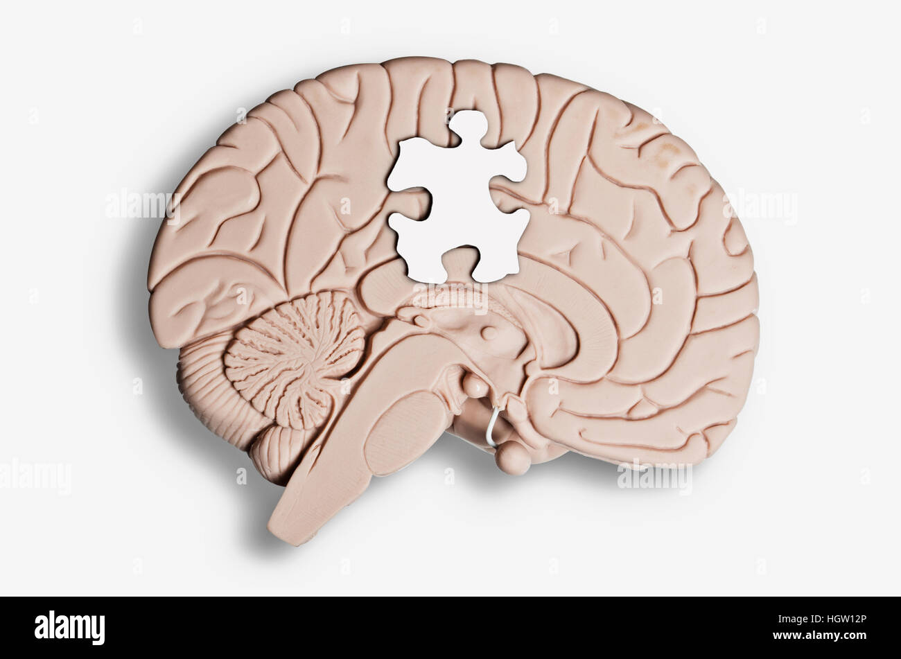 Puzzle Piece Placed On A Brain Model Stock Photo