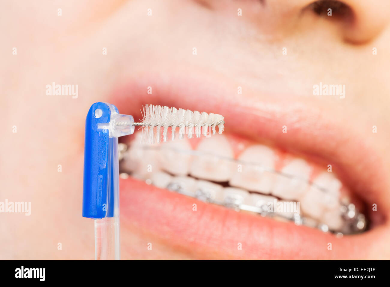 Special interdental brush for braces Stock Photo Alamy