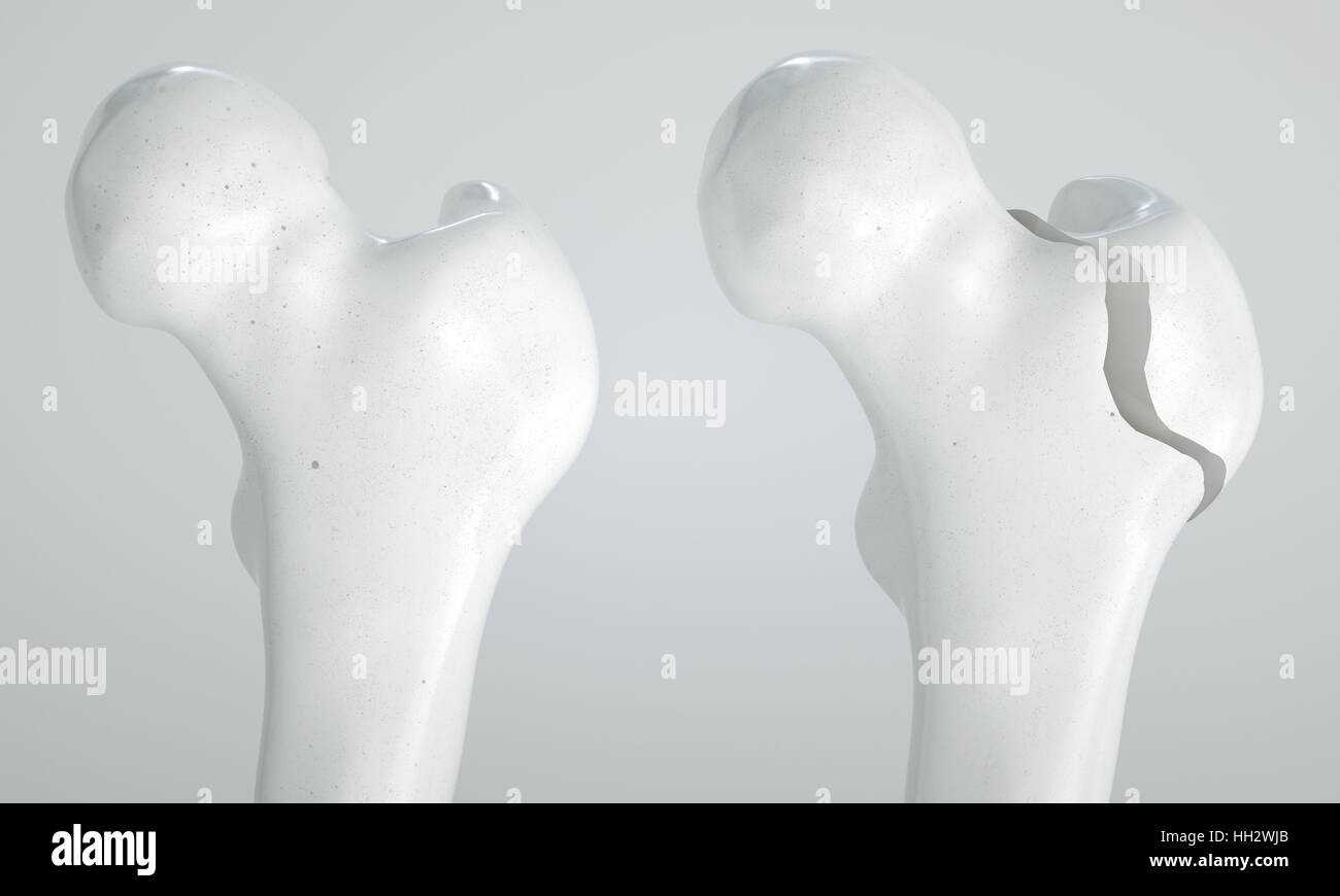 Anatomy Hip Joint Diagram Stock Photos & Anatomy Hip Joint Diagram