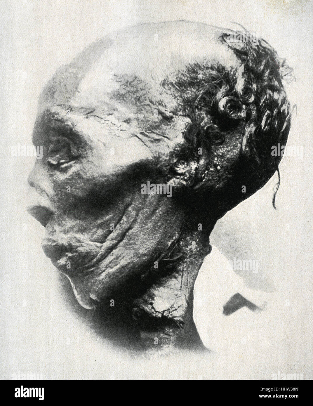 Thutmose II  / Thutmosis / Tuthmosis. IHead of mummy.  4th  Pharaoh of the Eighteenth dynasty. Married to Hatshepsut.  Cairo Stock Photo