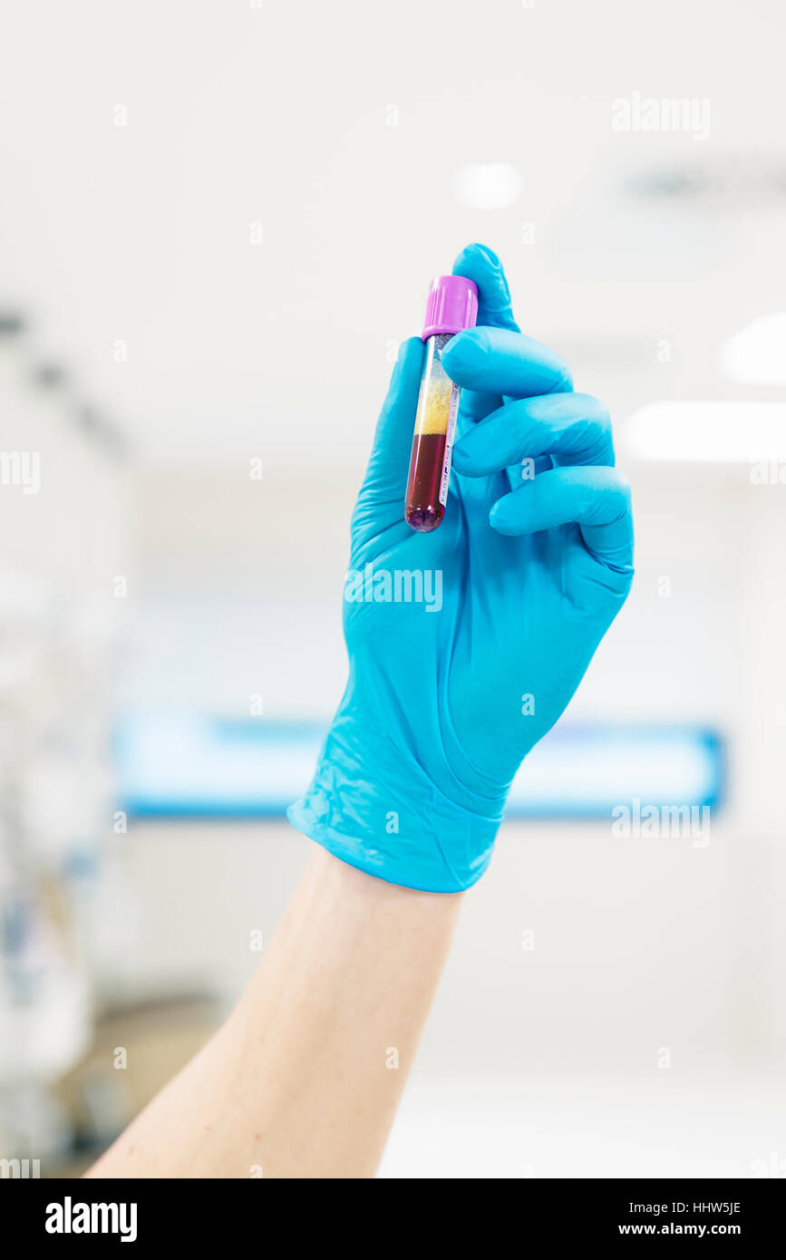 hand holding blood in test tube. Hospital Stock Photo Alamy