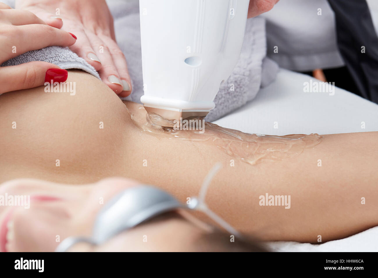 woman at cosmetics salon, legs underarm mustache laser epilation Stock Photo