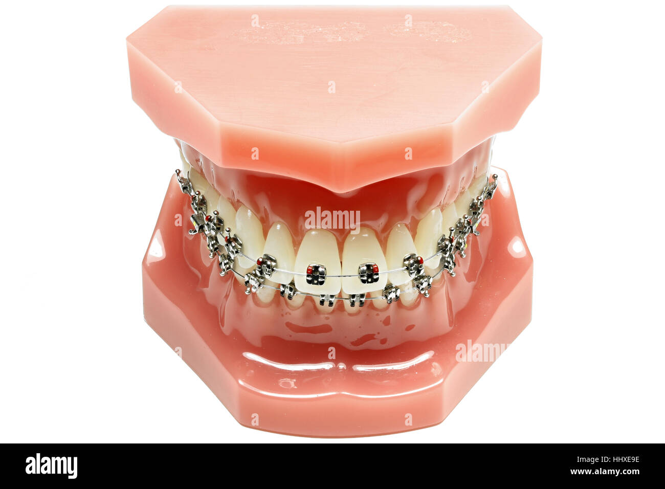 tooth model with metal wired dental braces isolated on white background ...
