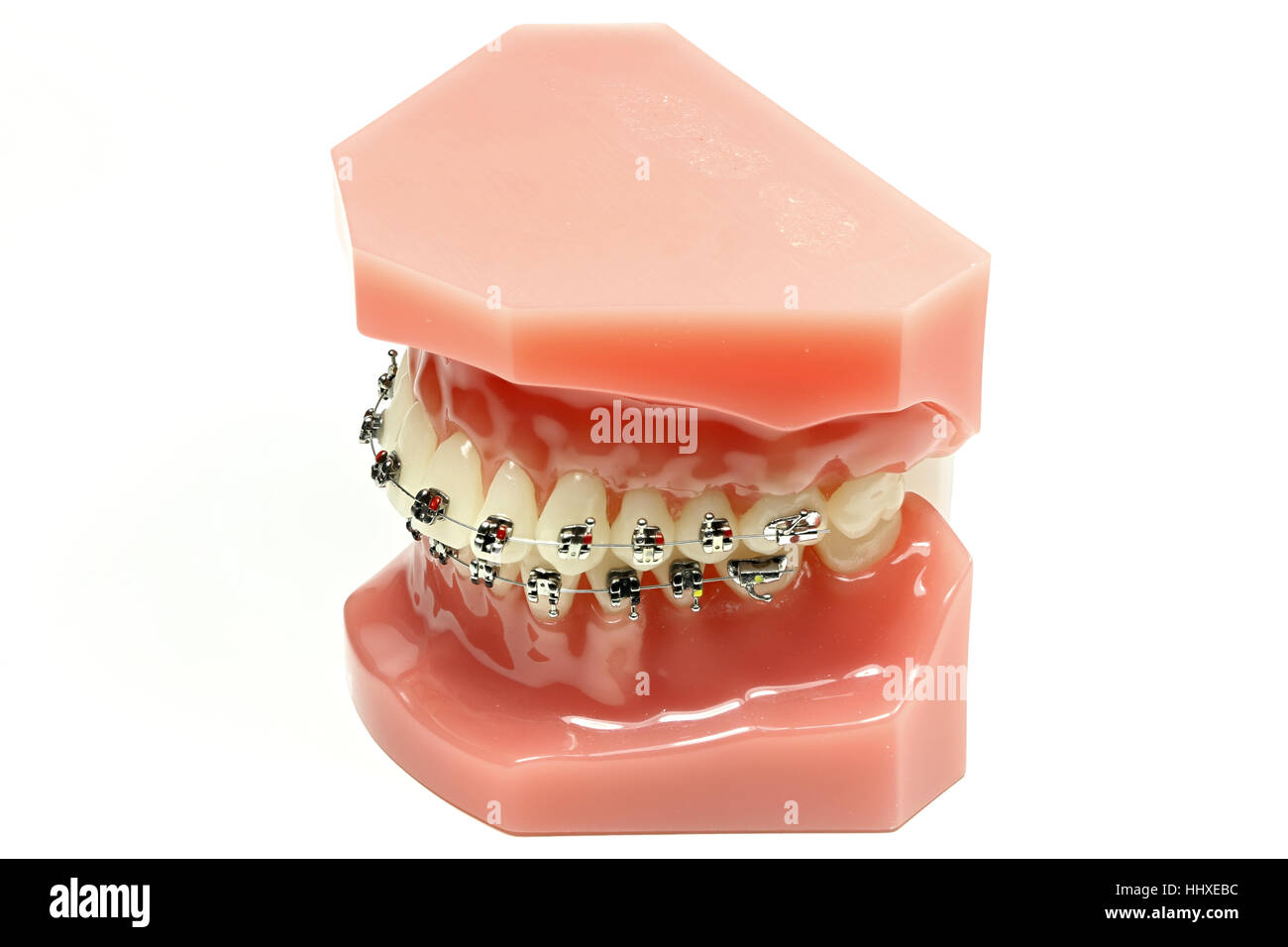 tooth model with metal wired dental braces isolated on white background ...