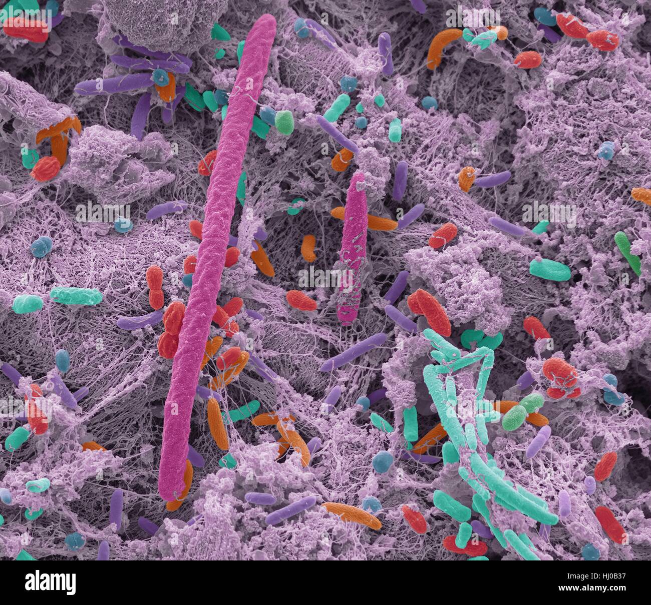 Oral bacteria. Coloured scanning electron micrograph (SEM) of mixed oral bacteria. The mouth contains a large number of bacteria, most of which are harmless or even beneficial. However, some bacteria can cause throat infections or cause the formation of plaque deposits on the teeth, which may lead to decay. Up to 700 species of oral bacteria exist with the average adult having between 30 and 70 different species of bacteria in their mouth. Magnification: x5000 at 10cm high. Stock Photo