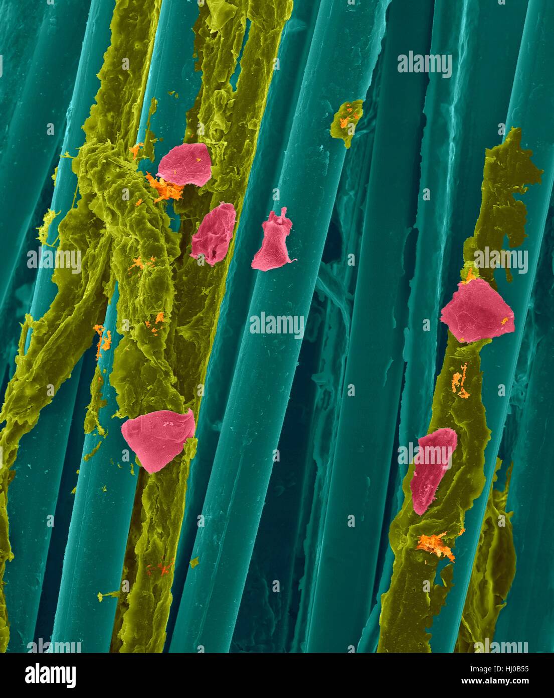 Used wax dental floss with dental plaque (yellow),bacteria (orange) cheek cells (pink) on dental floss fibres (blue),coloured scanning electron micrograph (SEM).Plaque consists of biofilm of bacteria embedded in glycoprotein matrix.The matrix is formed from bacterial secretions saliva.The Stock Photo