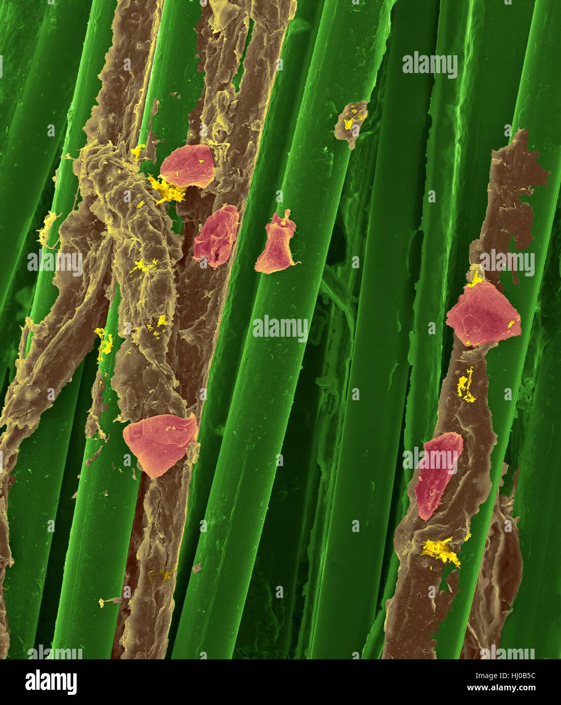 Used wax dental floss with dental plaque (brown),bacteria (yellow) cheek cells (purple) on dental floss fibres (green),coloured scanning electron micrograph (SEM).Plaque consists of biofilm of bacteria embedded in glycoprotein matrix.The matrix is formed from bacterial secretions saliva.The Stock Photo