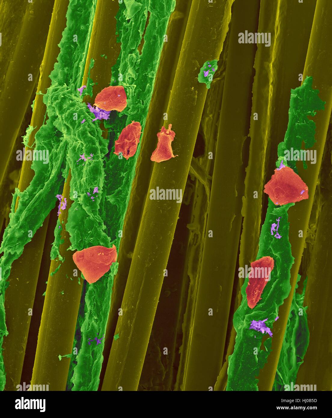 Used wax dental floss with dental plaque (green),bacteria (purple) cheek cells (red) on dental floss fibres (yellow),coloured scanning electron micrograph (SEM).Plaque consists of biofilm of bacteria embedded in glycoprotein matrix.The matrix is formed from bacterial secretions saliva.The Stock Photo