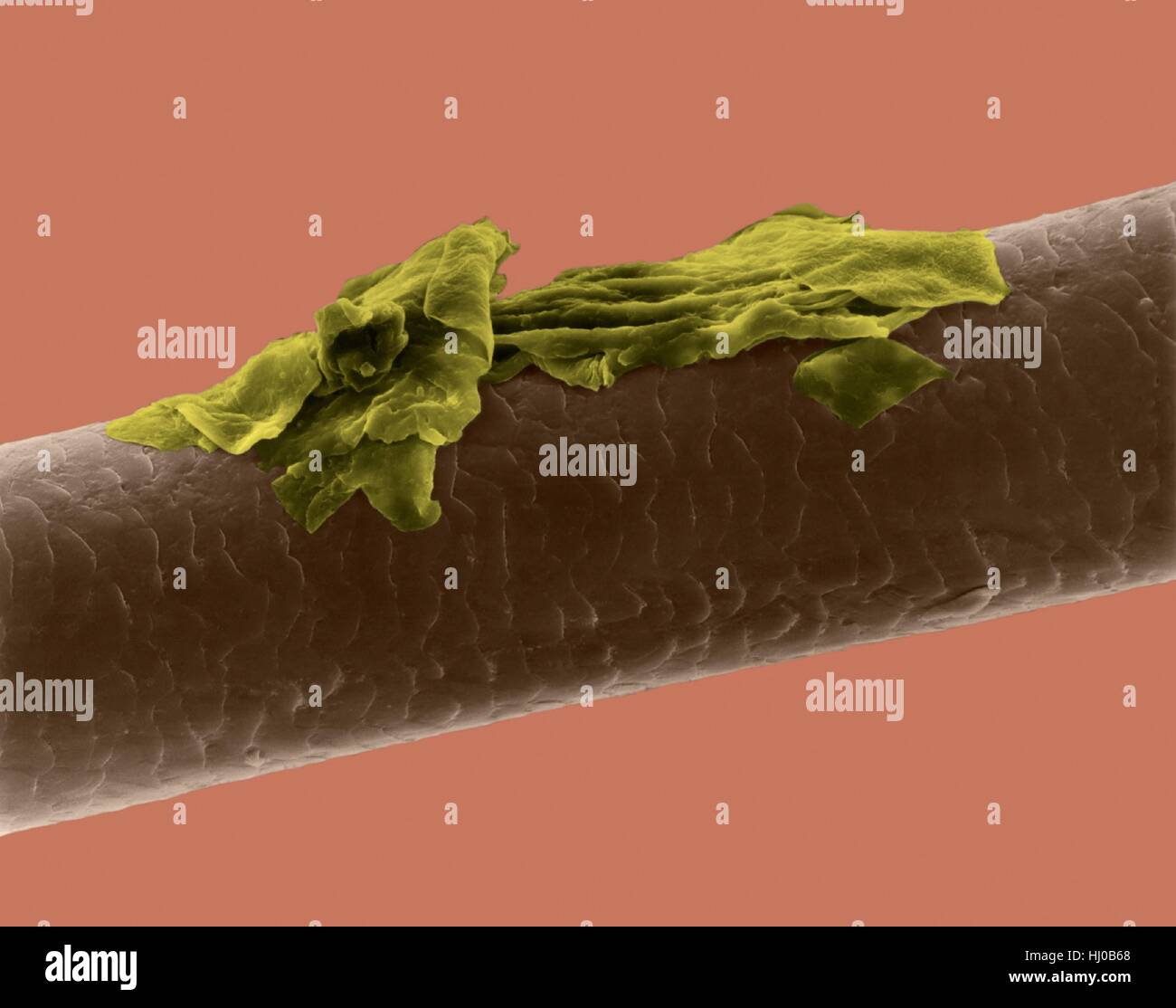 Human hair dandruff,coloured scanning electron micrograph (SEM).The outer layer of hair (the cuticle) has overlapping scales of keratin.These scales are thought to prevent hairs from matting together.Hair is made up of fibrous protein called keratin.Internally hair shaft is divided into three concentric sheaths (layers) called medulla,cortex outer cuticle.Hair is non-living tissue.Hair grows from hair root (bulb) embedded in skin.Hair growth occurs when epidermal cells divide at base of root bulb.Hair is non-living tissue.Magnification: x115 when shortest axis printed at 25 millimetres. Stock Photo