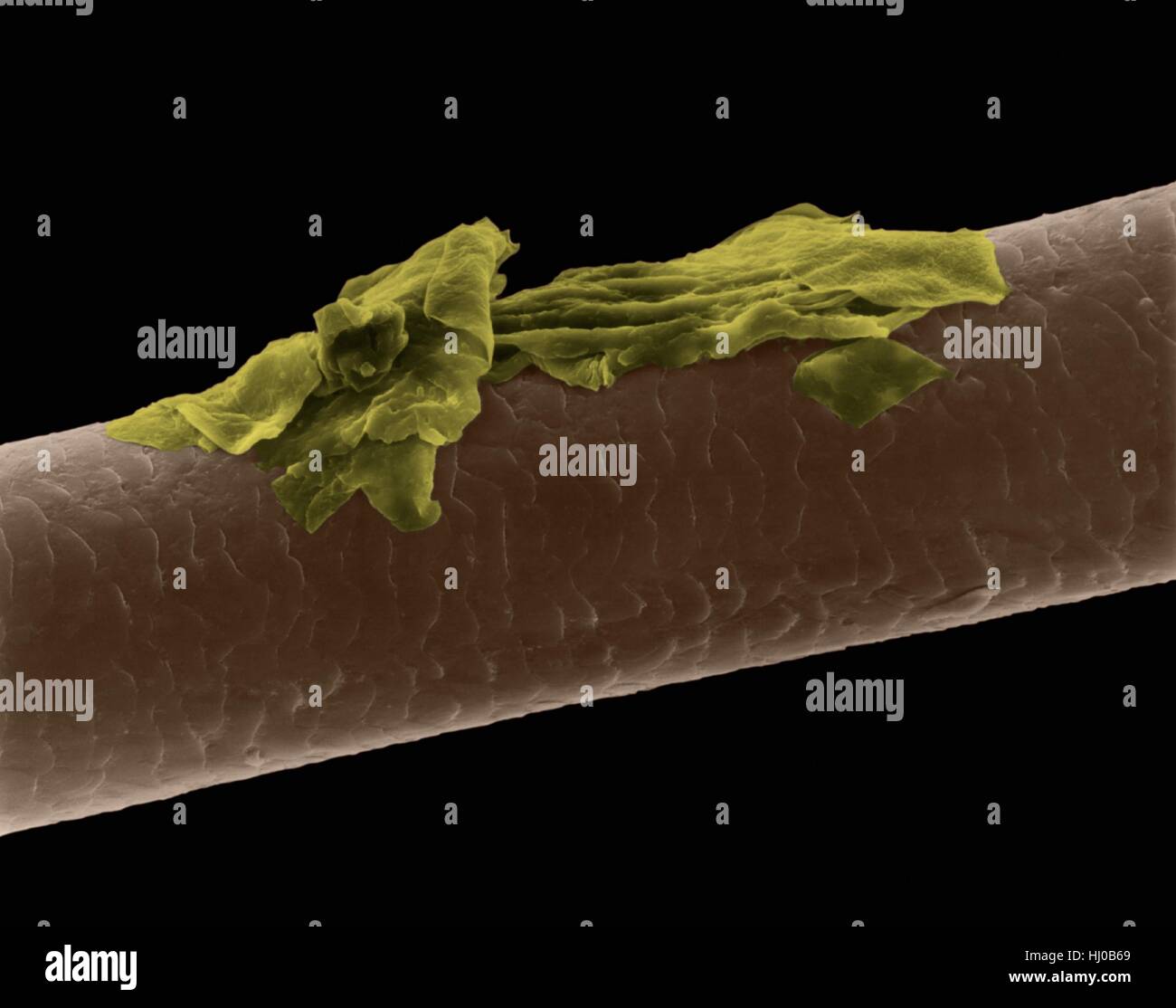 Human hair dandruff,coloured scanning electron micrograph (SEM).The outer  layer of hair (the cuticle) has overlapping scales of  scales  are thought to prevent hairs from matting  is made up of  fibrous