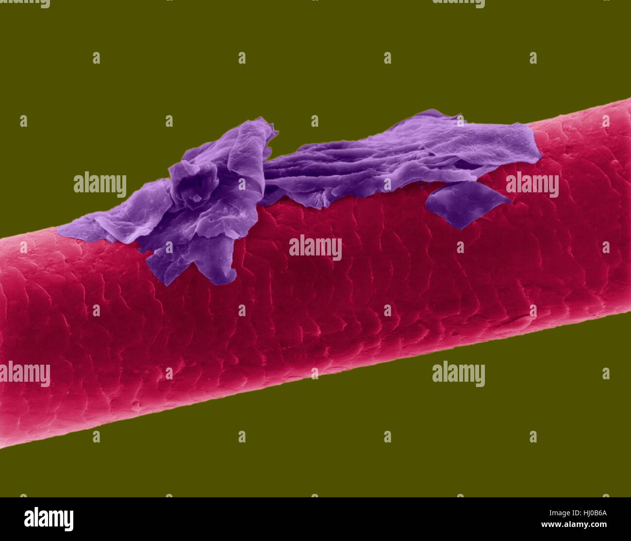 Human hair dandruff,coloured scanning electron micrograph (SEM).The outer layer of hair (the cuticle) has overlapping scales of keratin.These scales are thought to prevent hairs from matting together.Hair is made up of fibrous protein called keratin.Internally hair shaft is divided into three concentric sheaths (layers) called medulla,cortex outer cuticle.Hair is non-living tissue.Hair grows from hair root (bulb) embedded in skin.Hair growth occurs when epidermal cells divide at base of root bulb.Hair is non-living tissue.Magnification: x115 when shortest axis printed at 25 millimetres. Stock Photo