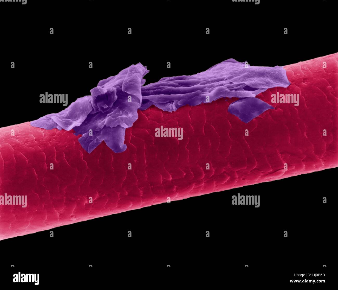 Human hair dandruff,coloured scanning electron micrograph (SEM).The outer layer of hair (the cuticle) has overlapping scales of keratin.These scales are thought to prevent hairs from matting together.Hair is made up of fibrous protein called keratin.Internally hair shaft is divided into three concentric sheaths (layers) called medulla,cortex outer cuticle.Hair is non-living tissue.Hair grows from hair root (bulb) embedded in skin.Hair growth occurs when epidermal cells divide at base of root bulb.Hair is non-living tissue.Magnification: x115 when shortest axis printed at 25 millimetres. Stock Photo