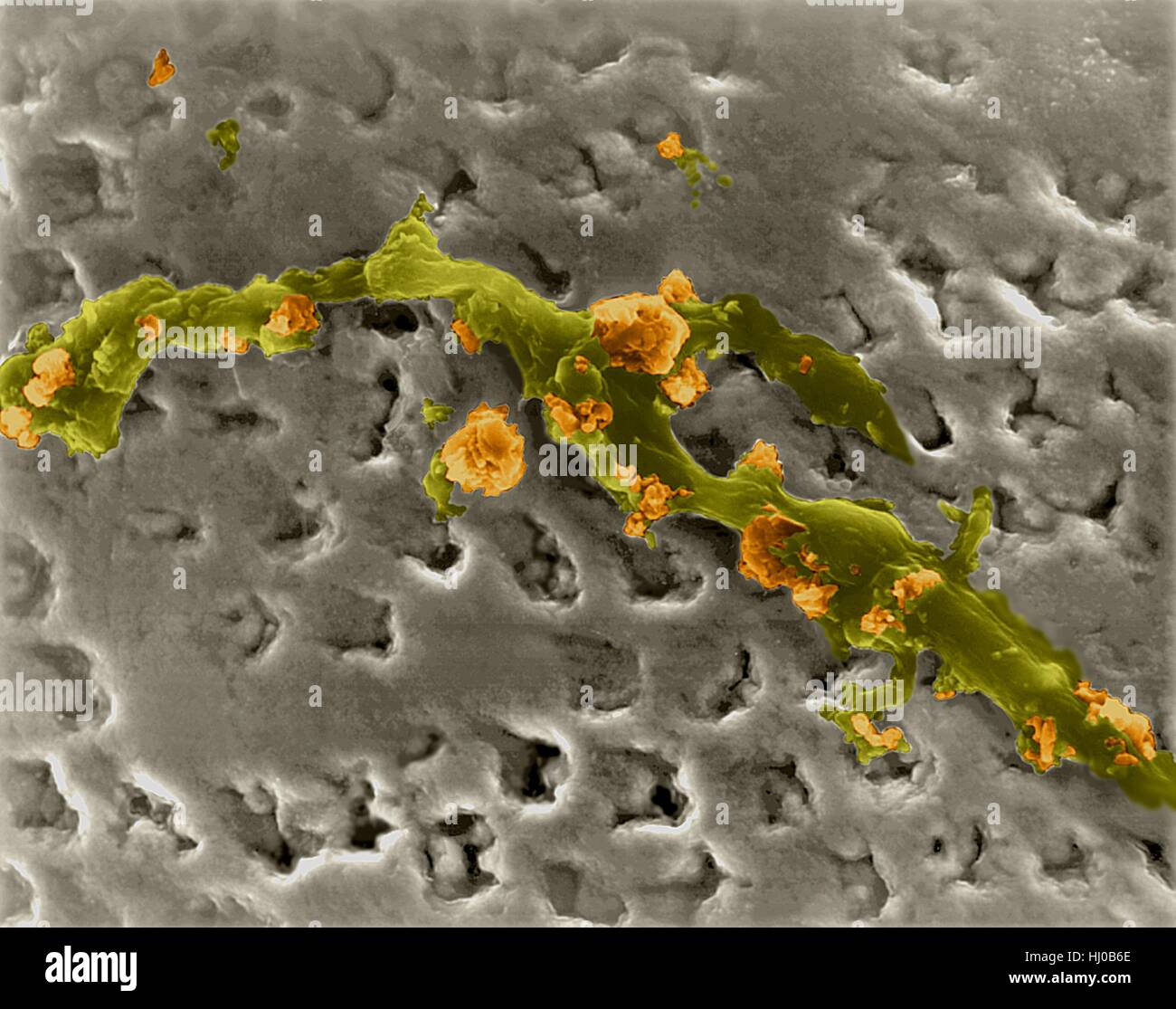 Human tooth accumulation of bacterial plaque (smooth areas) calcified tartar (rough areas) on enamel surface,coloured scanning electron micrograph (SEM).Plaque is sticky,colourless film of bacteria that forms on teeth.You can sense this film due to your tongue feeling silky surface on your teeth.It Stock Photo