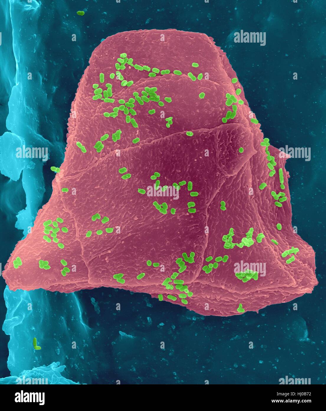 Used wax dental floss with cheek cells (purple) bacteria (green) on dental floss fibres (blue),coloured scanning electron micrograph (SEM).Cheek cells often get scraped from inside of your mouth when flossing your teeth.Numerous bacteria are present as part of normal mouth flora.Bacterial plaque Stock Photo