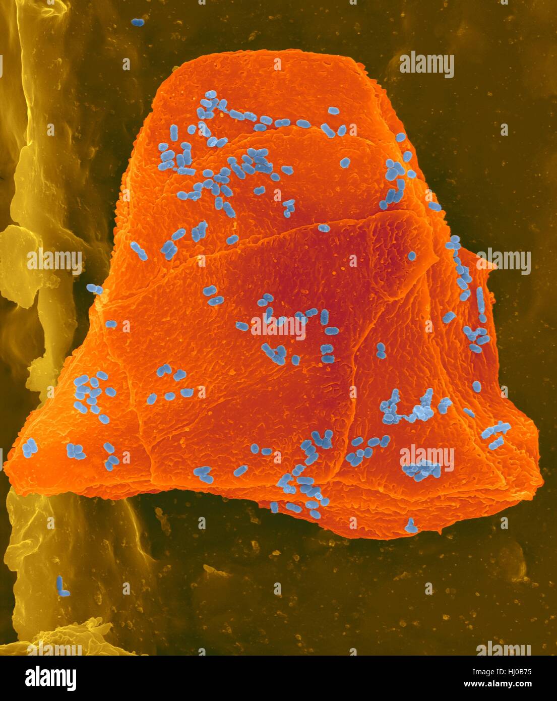 Used wax dental floss with cheek cells (orange) bacteria (blue) on dental floss fibres (brown),coloured scanning electron micrograph (SEM).Cheek cells often get scraped from inside of your mouth when flossing your teeth.Numerous bacteria are present as part of normal mouth flora.Bacterial plaque Stock Photo