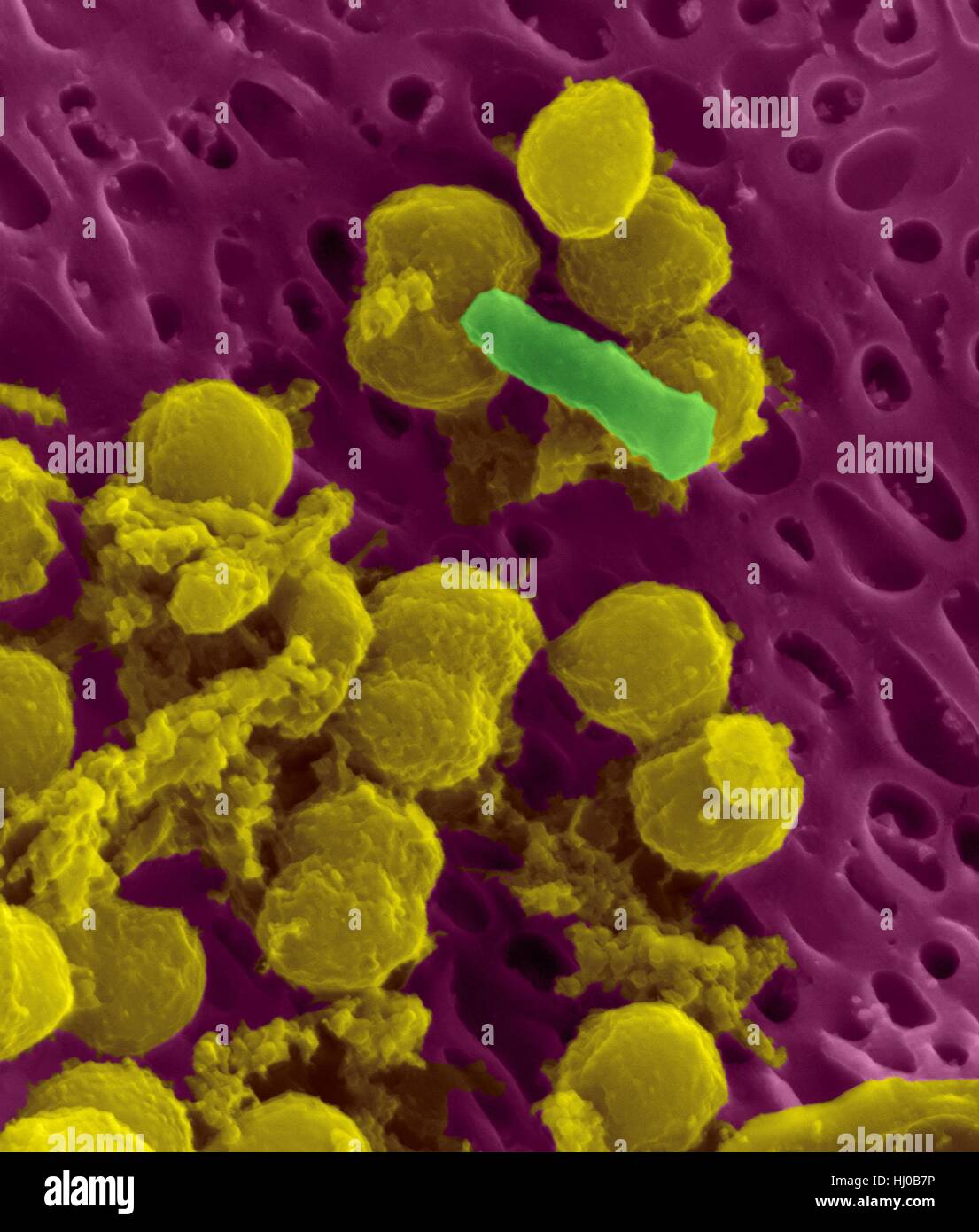 Streptococcus mutans bacteria hires stock photography and images Alamy