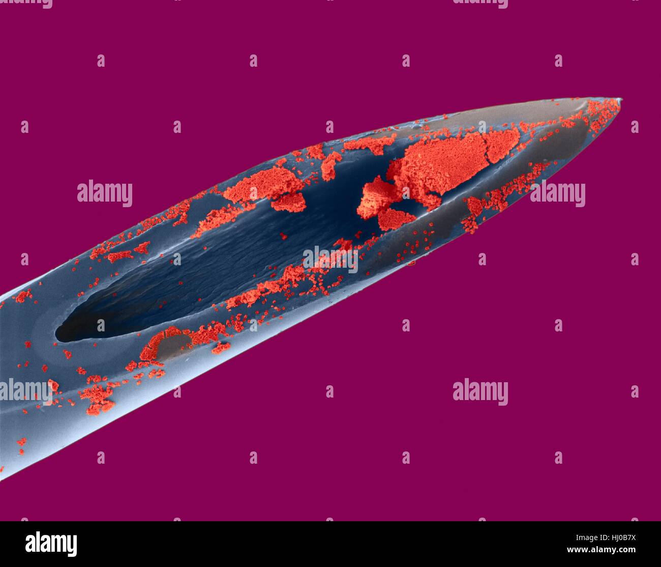 Hypodermic needle (26 gauge) with human blood,coloured scanning