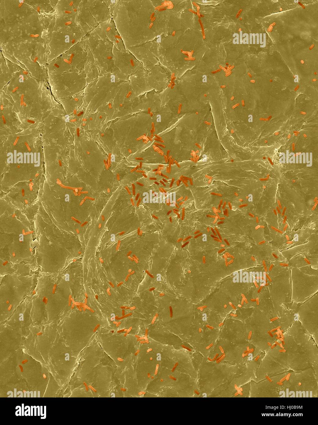 Coloured scanning electron micrograph (SEM) of Photocomposite,E.coli on surface of human skin.Escherichia coli is Gram-negative,facultatively anaerobic,enteric,rod prokaryote.This bacterium is normally part of human animal microbiota.Most E.coli strains are harmless,but some strains can cause serious problems such as: food poisoning,urinary tract infections,traveller's diarrhoea nosocomial infections.The E.coli 0157:H7 strain is fatal to humans if contracted when contaminated meat is cooked inadequately.Magnification: bacteria x200; skin x200 when shortest axis printed at 25 millimetres. Stock Photo