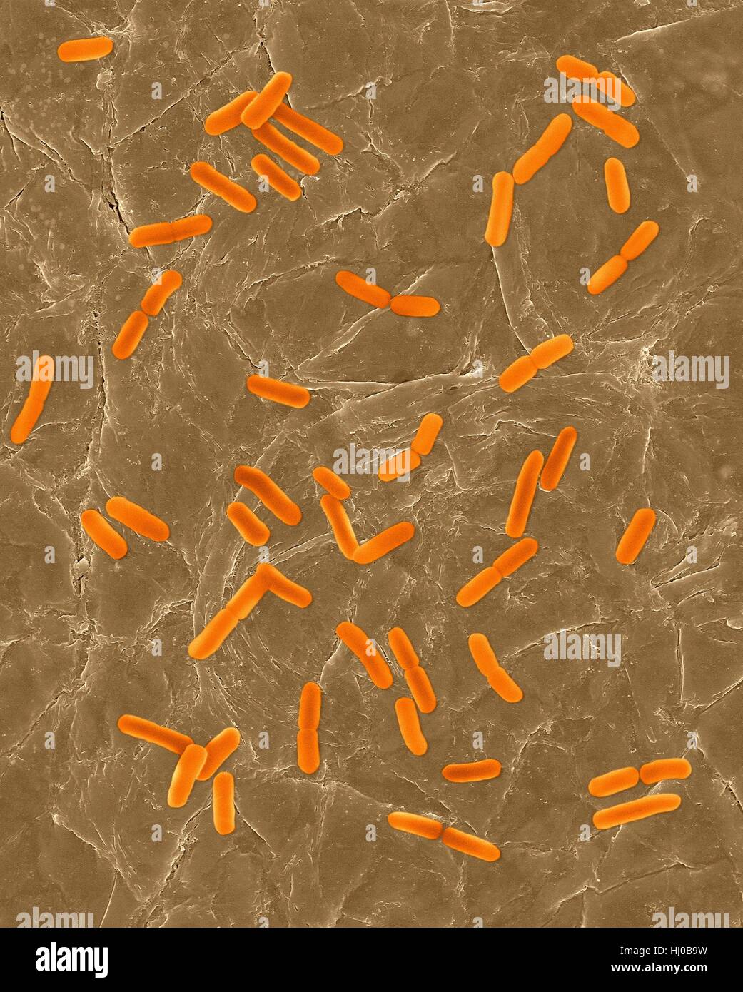 Coloured scanning electron micrograph (SEM) of Photocomposite,E.coli on surface of human skin.Escherichia coli is Gram-negative,facultatively anaerobic,enteric,rod prokaryote.This bacterium is normally part of human animal microbiota.Most E.coli strains are harmless,but some strains can cause serious problems such as: food poisoning,urinary tract infections,traveller's diarrhoea nosocomial infections.The E.coli 0157:H7 strain is fatal to humans if contracted when contaminated meat is cooked inadequately.Magnification: bacteria x800; skin x200 when shortest axis printed at 25 millimetres. Stock Photo