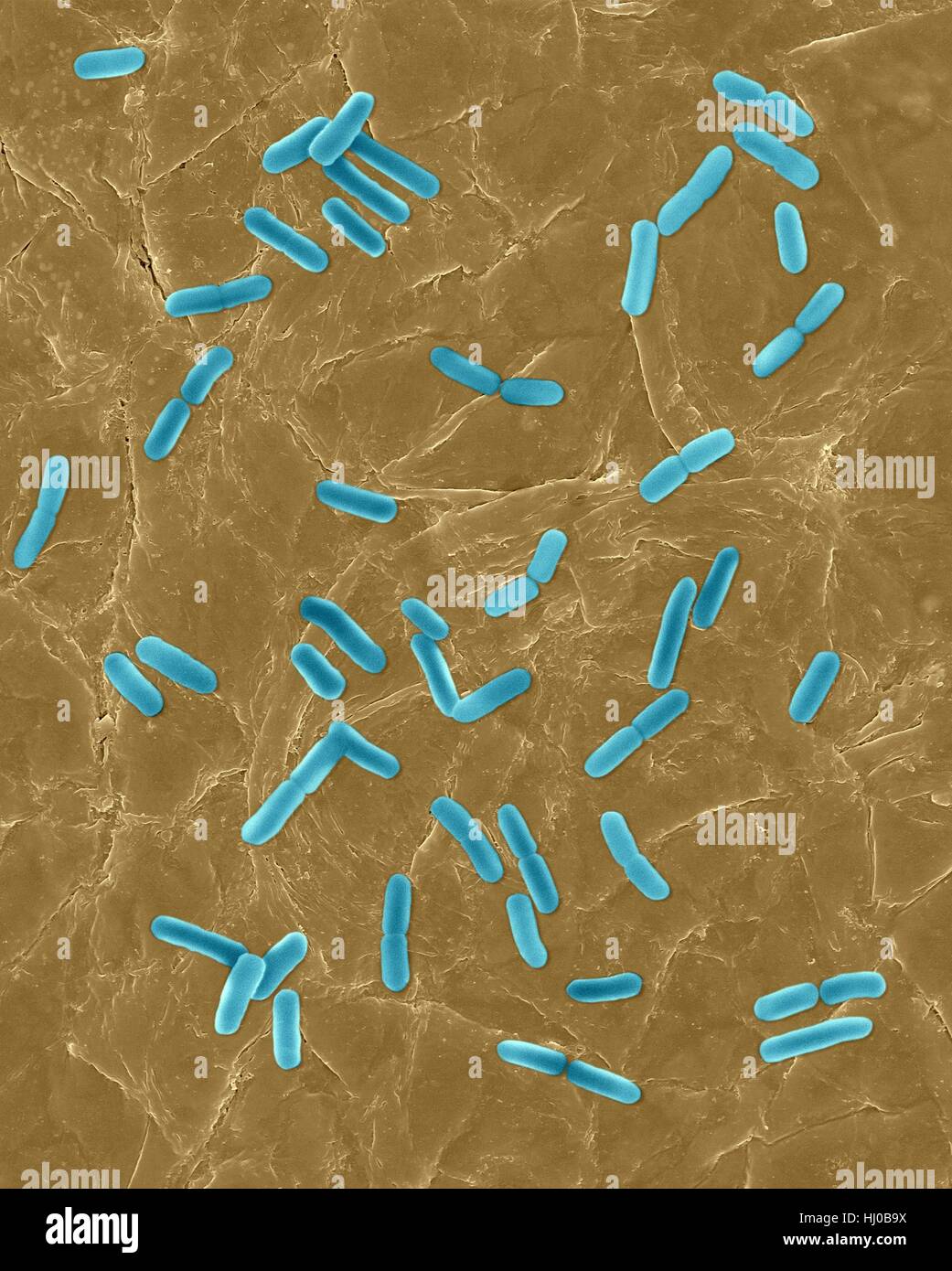 Coloured scanning electron micrograph (SEM) of Photocomposite,E.coli on surface of human skin.Escherichia coli is Gram-negative,facultatively anaerobic,enteric,rod prokaryote.This bacterium is normally part of human animal microbiota.Most E.coli strains are harmless,but some strains can cause serious problems such as: food poisoning,urinary tract infections,traveller's diarrhoea nosocomial infections.The E.coli 0157:H7 strain is fatal to humans if contracted when contaminated meat is cooked inadequately.Magnification: bacteria x800; skin x200 when shortest axis printed at 25 millimetres. Stock Photo