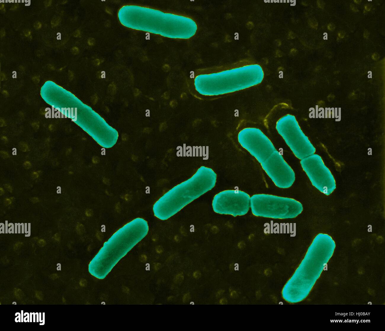 Coloured scanning electron micrograph (SEM) of Escherichia coli is a Gram-negative, facultatively anaerobic, enteric, rod prokaryote. This bacterium was isolated from the human intestine and is normally a part of the human and animal microbiota. Most E. coli strains are harmless, but some strains can cause serious problems such as: food poisoning, urinary tract infections, traveller's diarrhoea and nosocomial infections. The E. coli 0157:H7 strain is fatal to humans if contracted when contaminated meat is cooked inadequately. Magnification: x2, 445 when shortest axis printed at 25 millimetres. Stock Photo