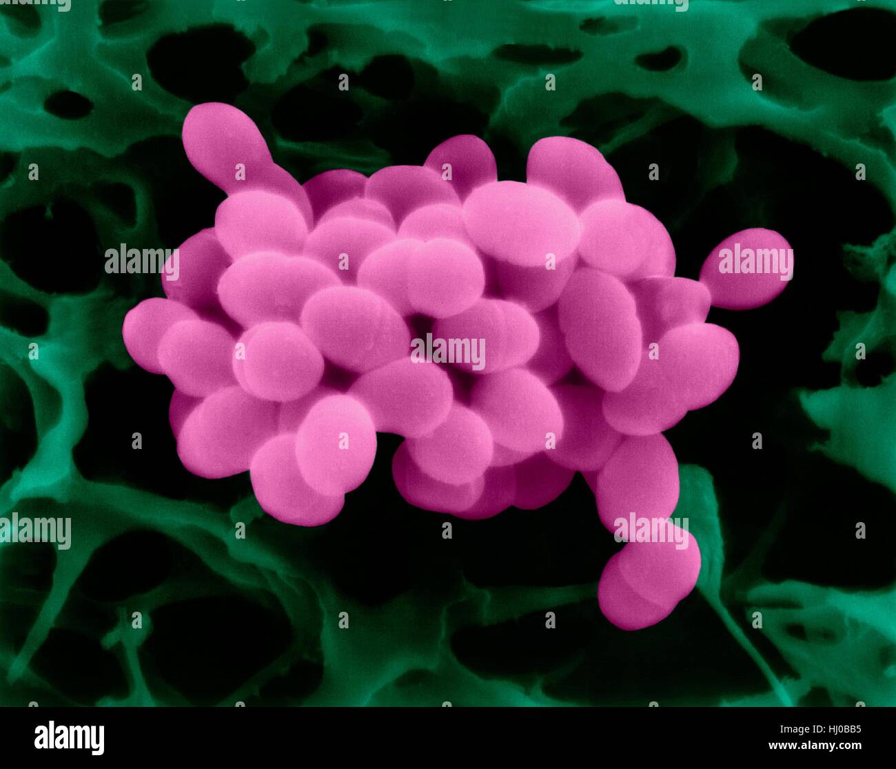 Coloured scanning electron micrograph (SEM) of Enterococcus faecalis (formerly known as Streptococcus faecalis),Gram positive,coccus prokaryote (dividing); causes skin wound infections such as scalded skin syndrome,scarlet fever,erysipelas impetigo.Group Streptococci.Enterococcus faecalis (formerly Stock Photo