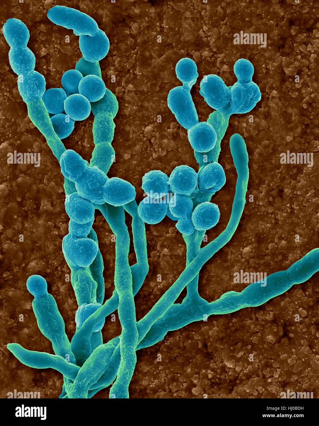 Coloured scanning electron micrograph (SEM) of common environmental allergenic mould (Cladosporium sp.); fungal hyphae producing spores.Also known as Hormodendrum sp.This specimen was found on inner surface of building's air supply duct.This genus is most common outdoor airborne mould but may occur Stock Photo