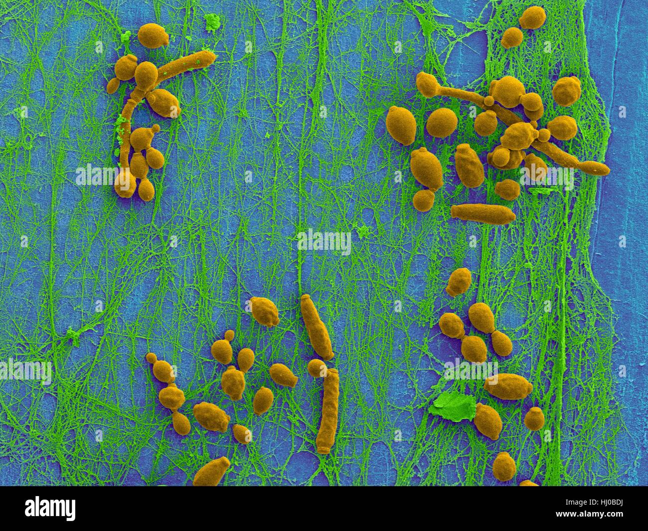 Coloured scanning electron micrograph (SEM) of Candida albicans infected medical catheter.A common yeast,C.albicans can colonize catheters resulting in serious tissue infections.Shown here is inner surface of infected catheter (removed from patient) revealing yeast biofilm (Candida Stock Photo