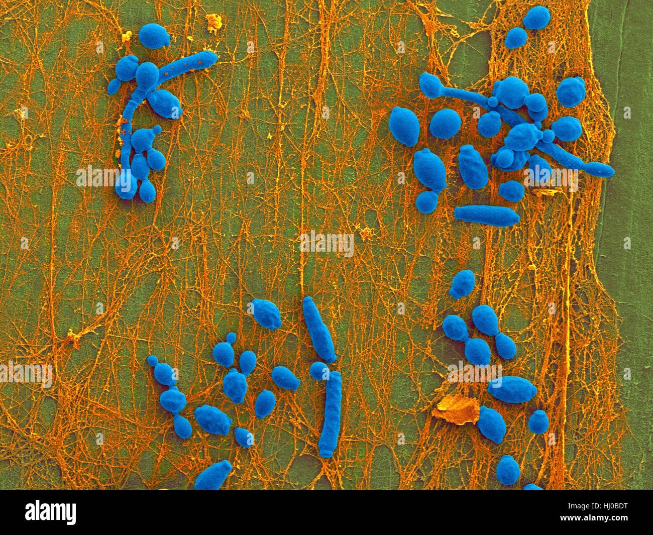 Coloured scanning electron micrograph (SEM) of Candida albicans infected medical catheter.A common yeast,C.albicans can colonize catheters resulting in serious tissue infections.Shown here is inner surface of infected catheter (removed from patient) revealing yeast biofilm (Candida Stock Photo