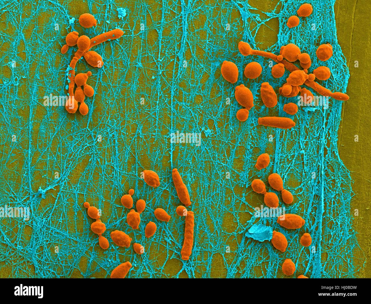 Coloured scanning electron micrograph (SEM) of Candida albicans infected medical catheter.A common yeast,C.albicans can colonize catheters resulting in serious tissue infections.Shown here is inner surface of infected catheter (removed from patient) revealing yeast biofilm (Candida Stock Photo