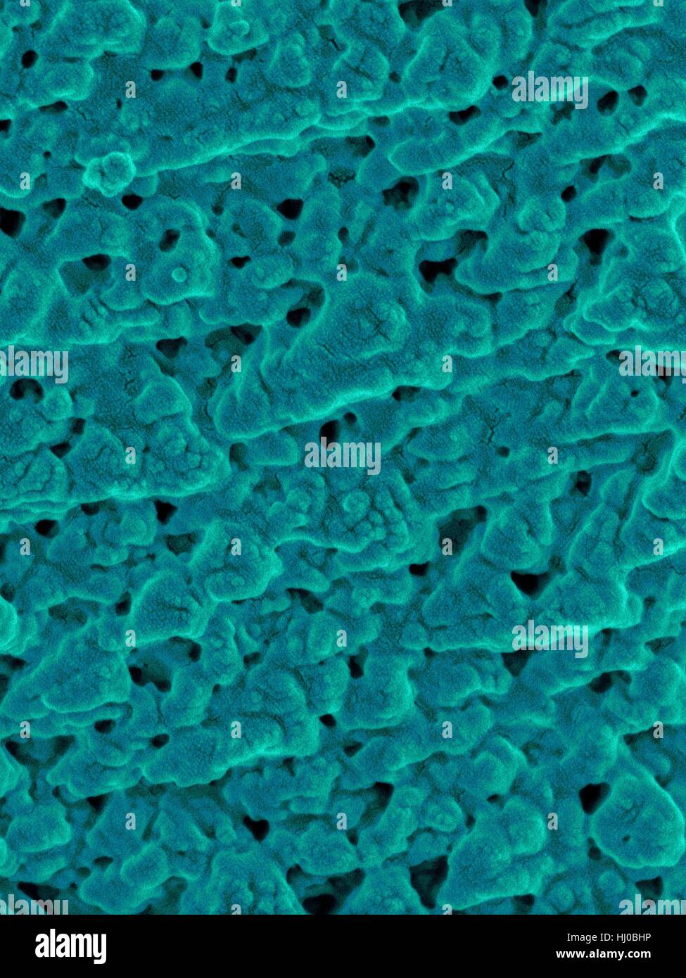 Coloured scanning electron micrograph (SEM) Emu eggshell surface tiny pores (Dromaius novaehollandiae).Calcium carbonate crystals make up Emu eggshell.Bird eggshells are semipermeable membranes composed of mineralized calcium carbonate filled thousands of pores.The eggshell protects embryo inside Stock Photo