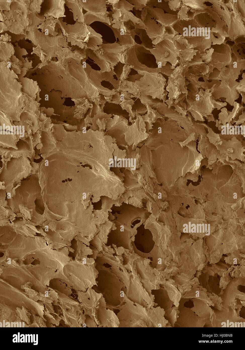 Coloured scanning electron micrograph (SEM) of White bread surface.Shown here is slice of white sandwich bread,revealing large airspaces that develop as result of action of yeast.White bread made from wheat flour that has bran germ removed through process known as milling.Milling gives white flour Stock Photo