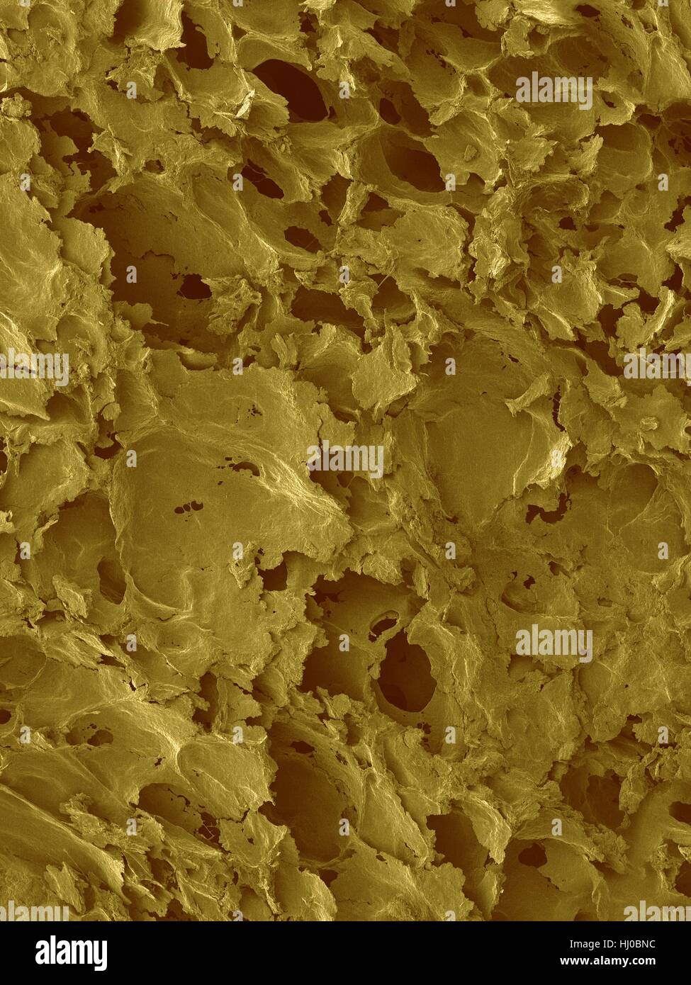 Coloured scanning electron micrograph (SEM) of White bread surface.Shown here is slice of white sandwich bread,revealing large airspaces that develop as result of action of yeast.White bread made from wheat flour that has bran germ removed through process known as milling.Milling gives white flour Stock Photo